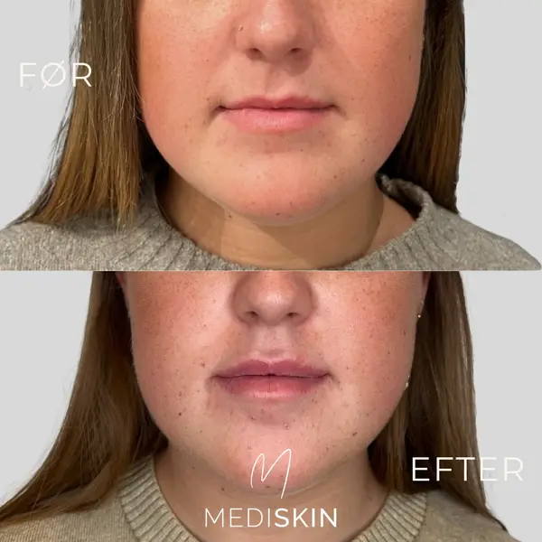 Instagram-opslag fra MediSkin